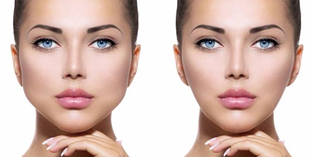 O que é a bichectomia e como funciona? - inspiração 1