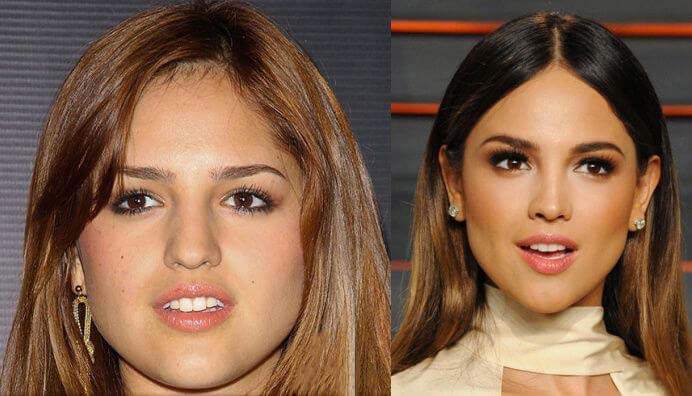 Resultados esperados e tempo de recuperação - inspiração 1