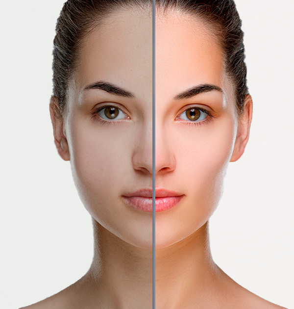 Resultados esperados e tempo de recuperação - inspiração 2