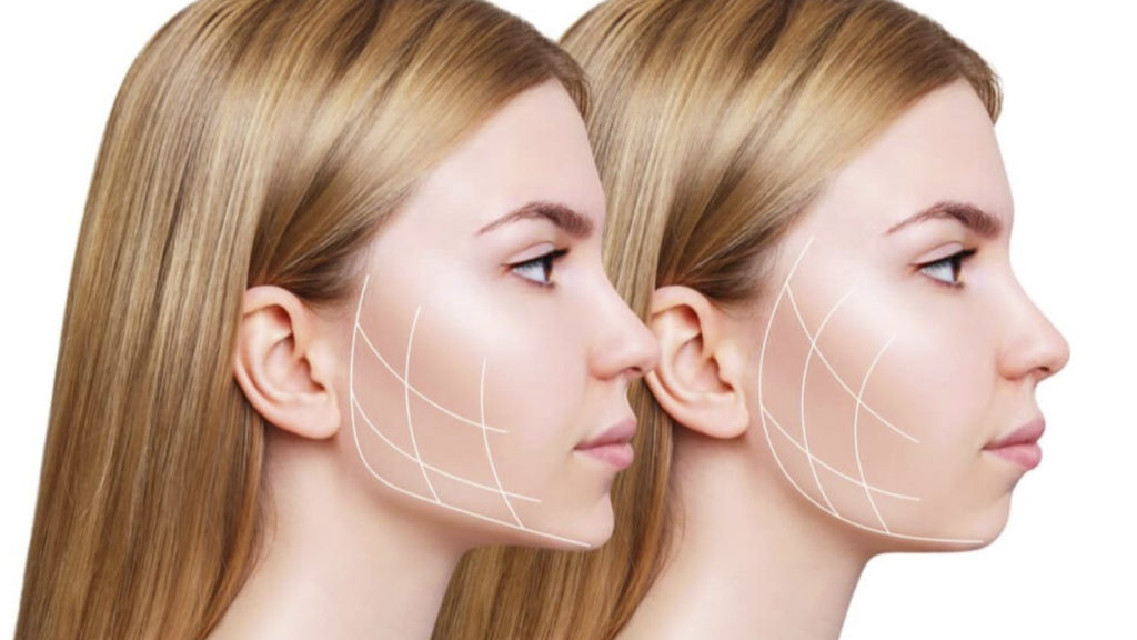 Diferença entre bichectomia e outros procedimentos faciais - inspiração 2