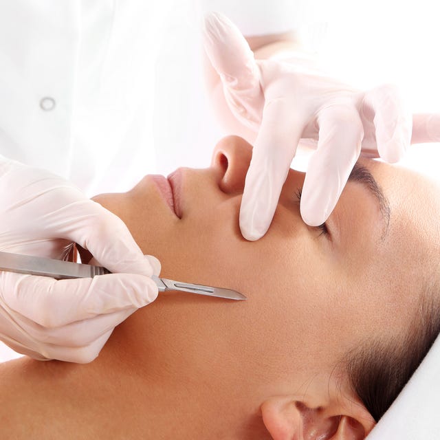 dermaplaning