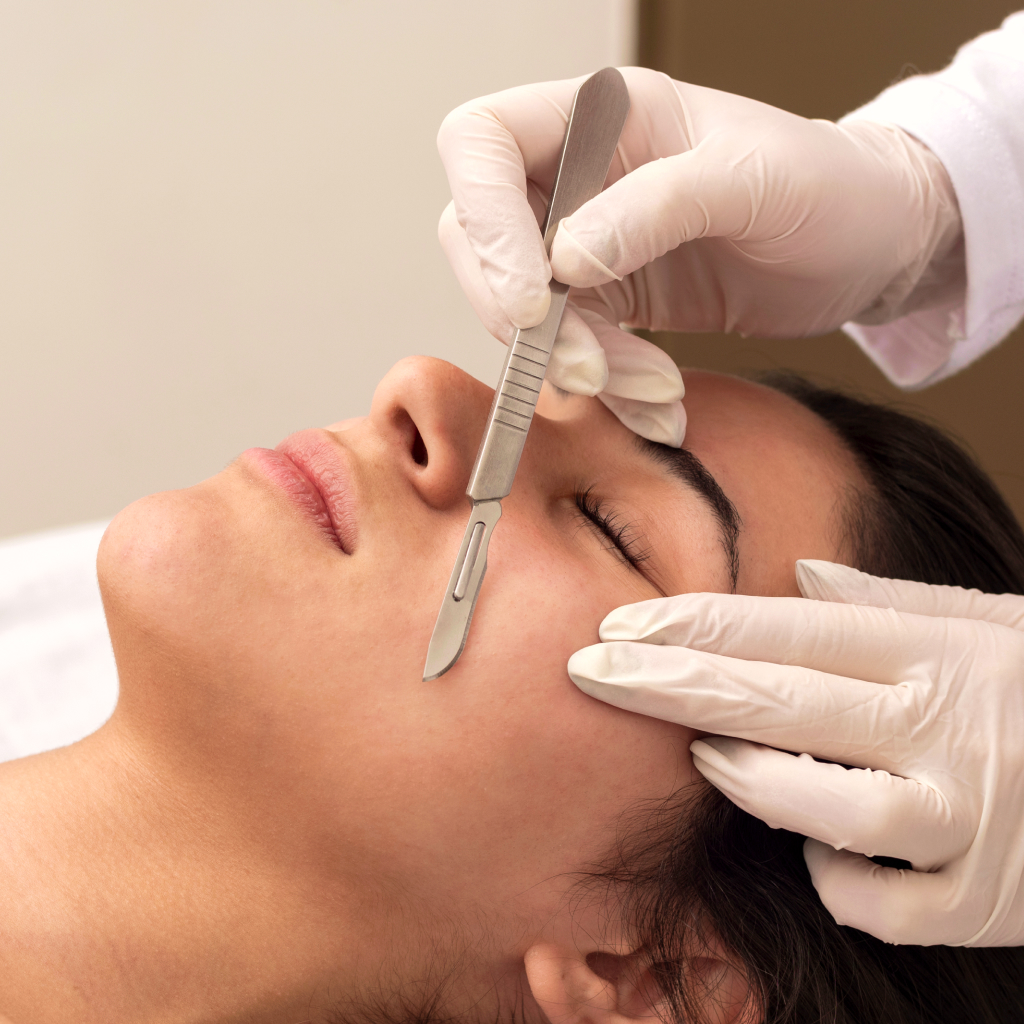 Como preparar a pele para o Dermaplaning em casa?