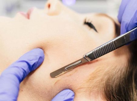Como preparar a pele para o Dermaplaning em casa?