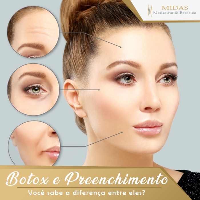 Botox: O Aliado Contra Rugas de Expressão - inspiração 2