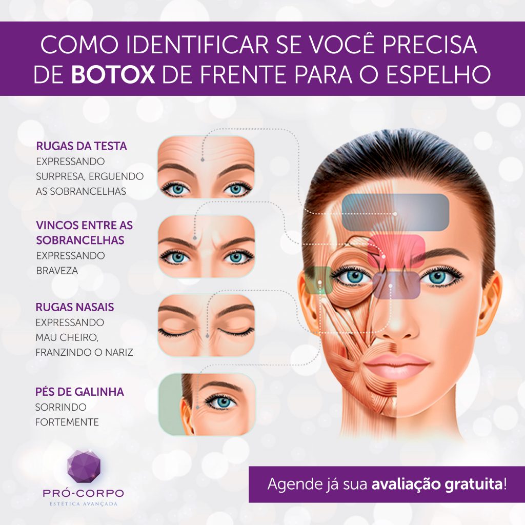 Como o Botox Age na Pele: Relaxamento Muscular - inspiração 2