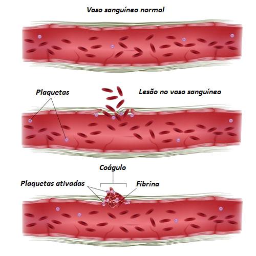 Entendendo as Plaquetas: Nossas Pequenas Guerreiras - inspiração 1