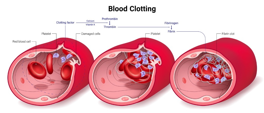 Desvendando o Mistério: Por Que o Sangue Coagula Automaticamente? - inspiração 1