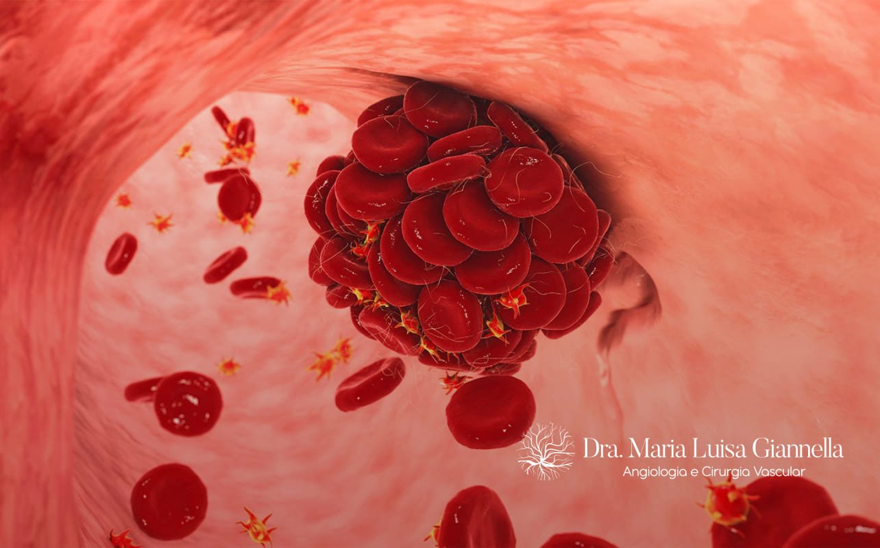 A Diferença Entre Coagulação Normal e Coagulação Excessiva - inspiração 1