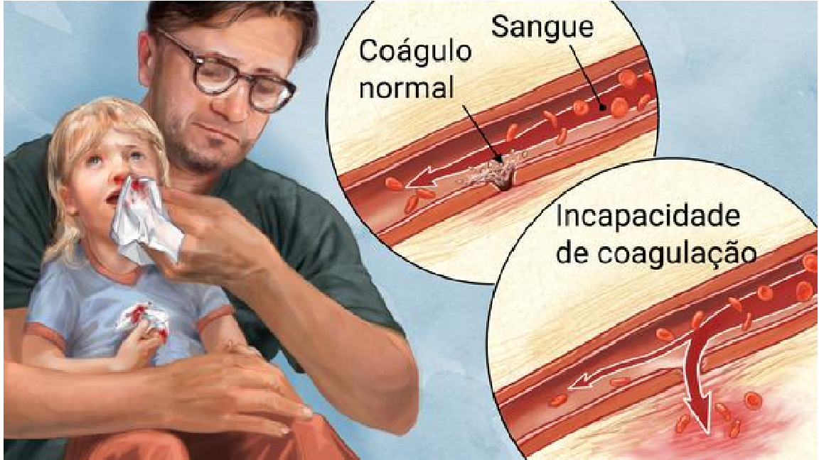 Por Que Sangramentos Podem Demorar Para Parar? - inspiração 2