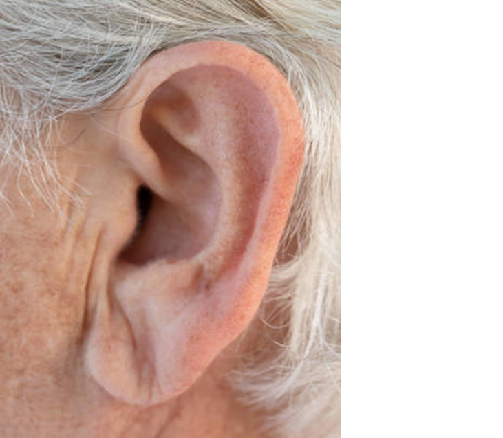 preenchimento de lóbulo de orelha