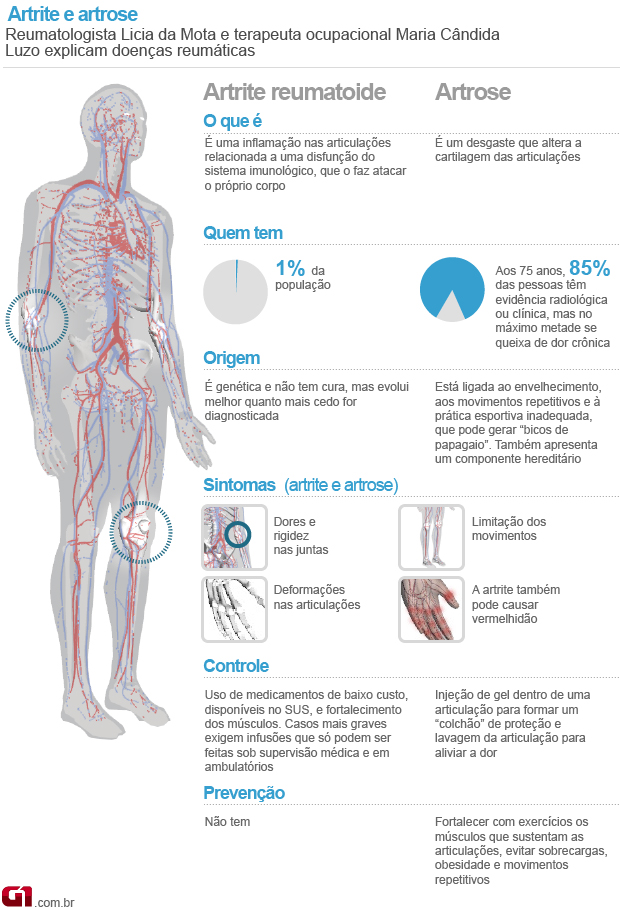 Fatores Que Levam à Artrose: Idade, Obesidade e Lesões - inspiração 1