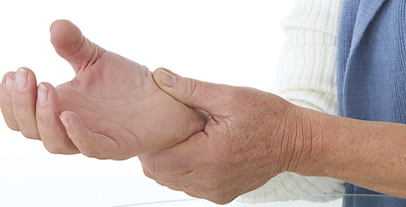 Tratamento para Artrite: Foco no Controle da Inflamação e Dor - inspiração 2