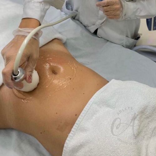 Radiofrequência vs. Outros Tratamentos Estéticos: Qual o Melhor para Você?