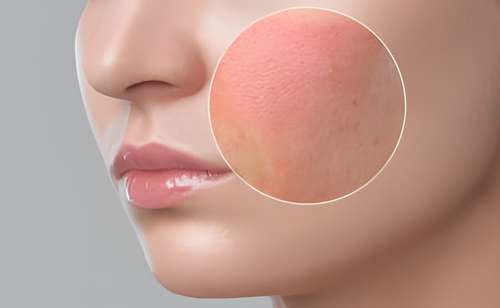 Como identificar e tratar alergia a maquiagem