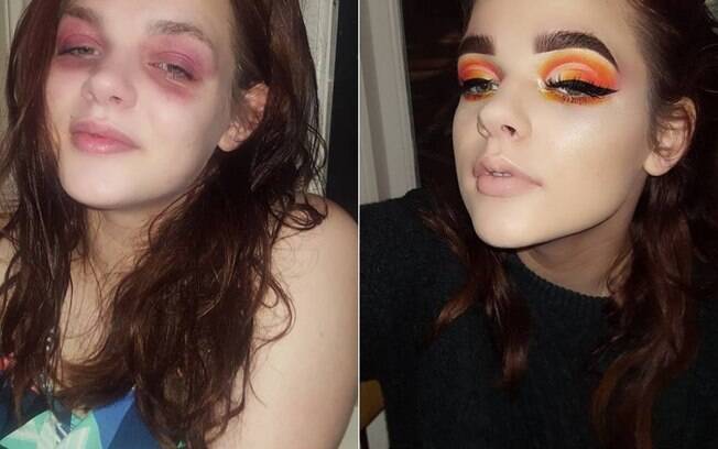 Ingredientes comuns que causam alergia em cosméticos