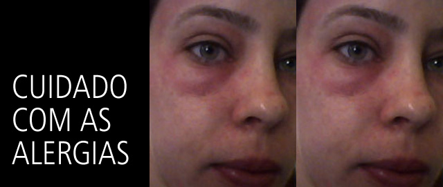 Diferença entre irritação e alergia a maquiagem