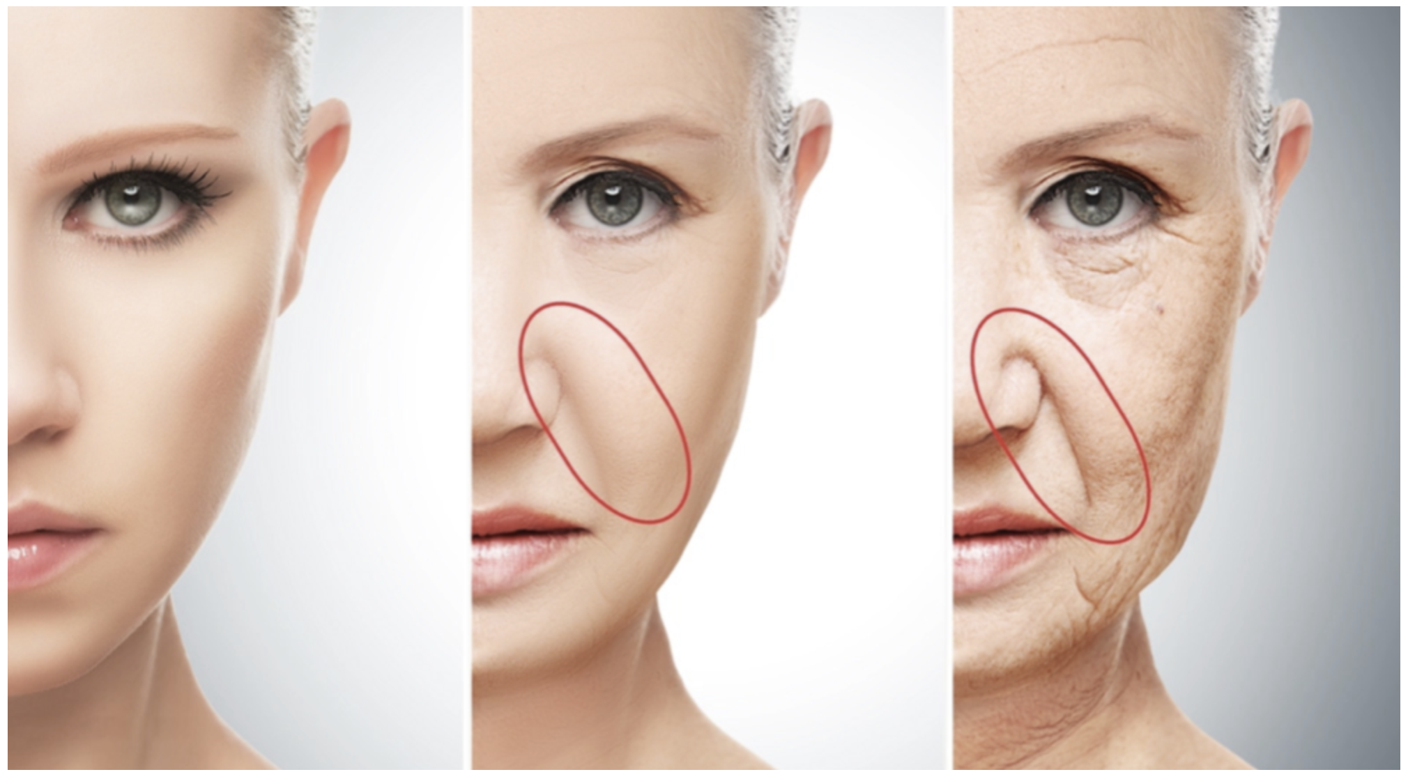 Prevenção do Bigode Chinês: Hábitos Diários Essenciais para uma Pele Jovem