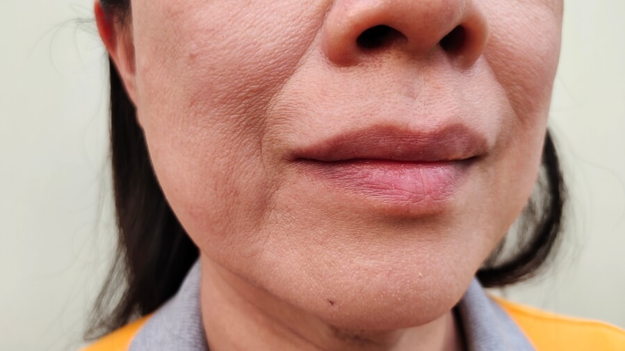 Exercícios Faciais para Bigode Chinês: Mitos e Verdades