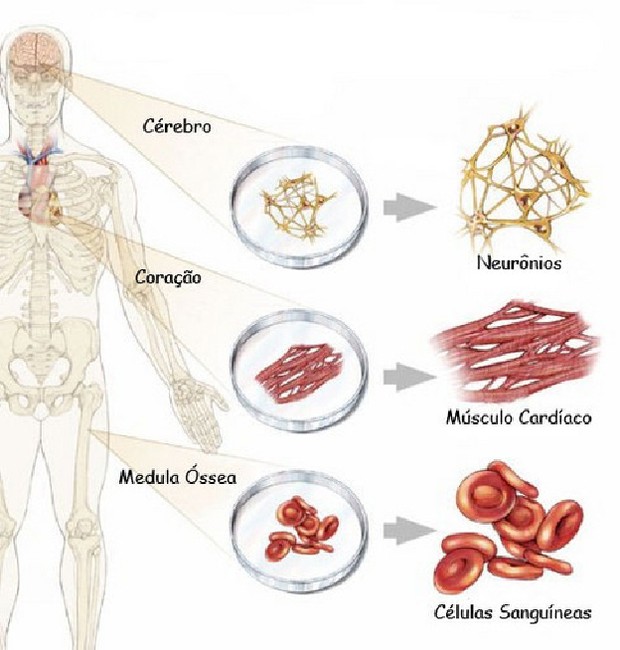 custo terapia células tronco