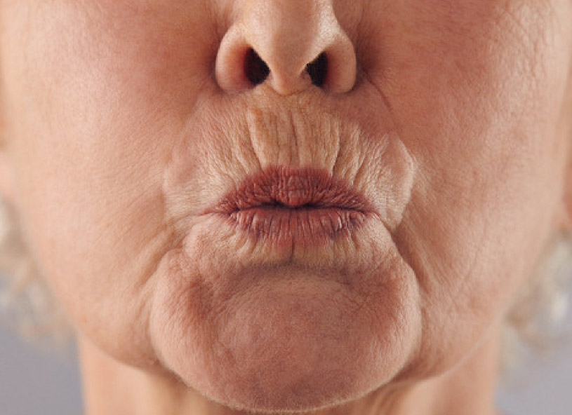 código de barras rugas