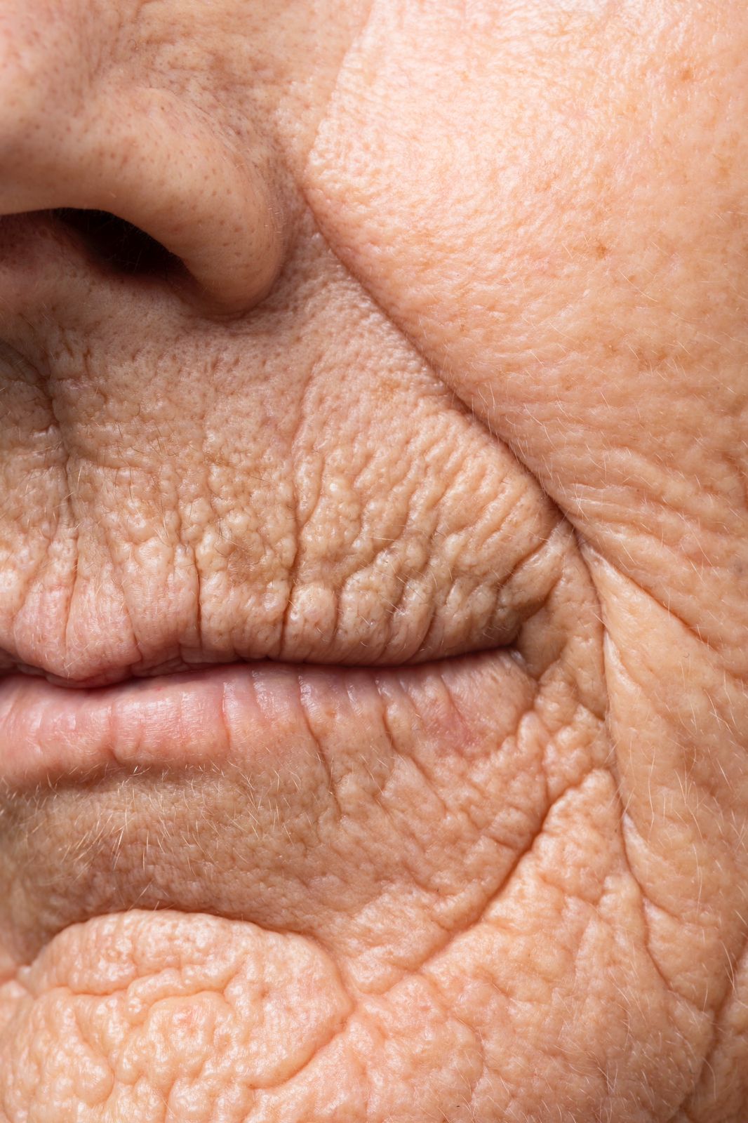 código de barras rugas