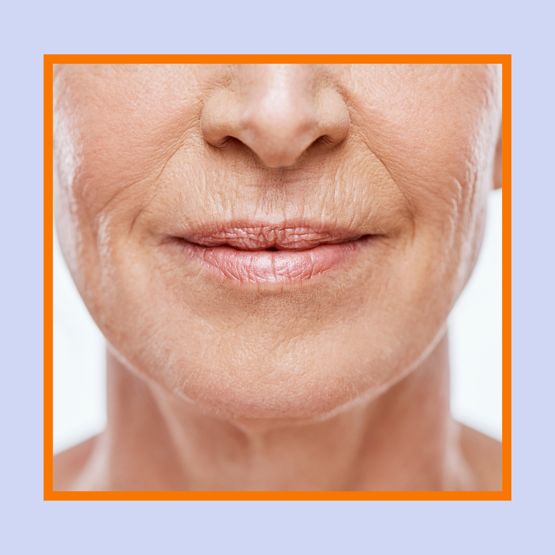 código de barras rugas