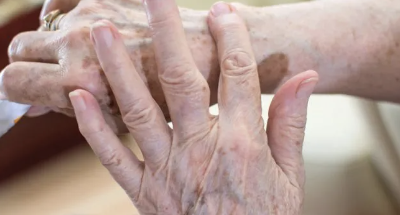 cuidados com a pele na menopausa