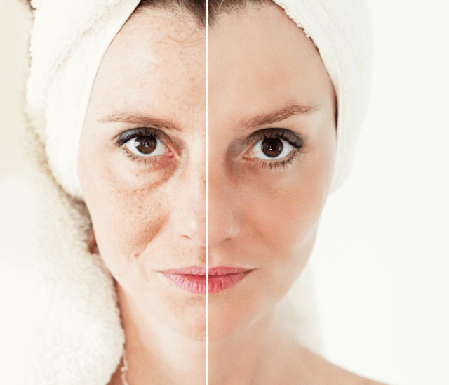 cuidados com a pele na menopausa