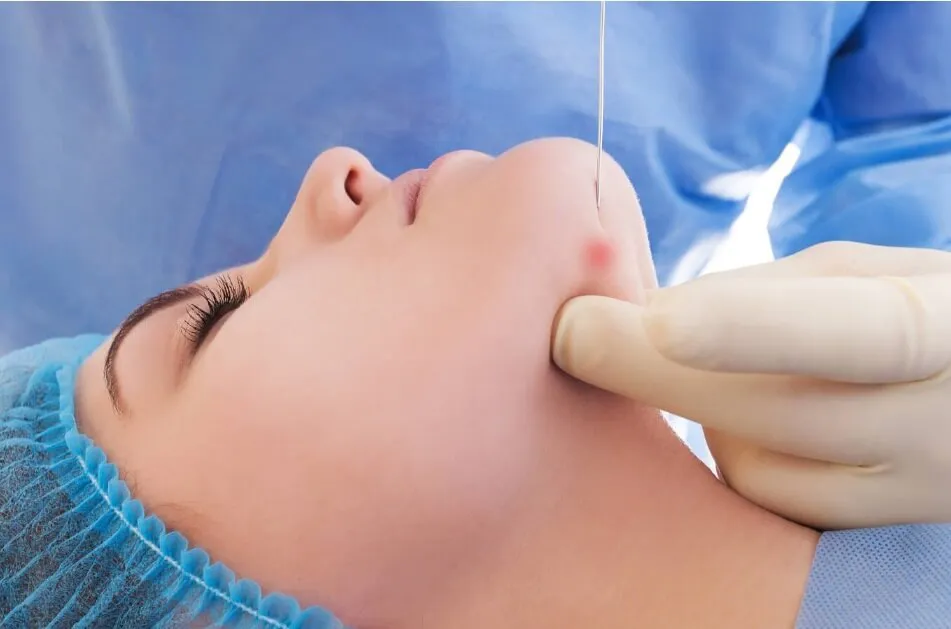 Endolaser para Gordura Localizada: Áreas de Tratamento e Resultados; Endolaser Facial: Como Combater a Flacidez e Rejuvenescer a Pele; Endolaser para Varizes: Guia Completo sobre o Procedimento e Preços; Endolaser: Riscos