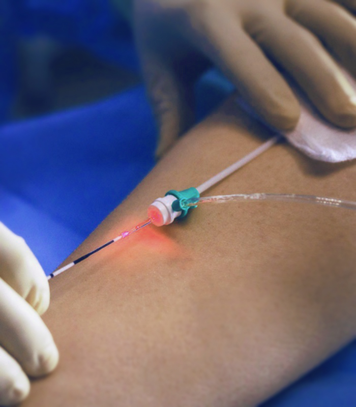 Endolaser para Gordura Localizada: Áreas de Tratamento e Resultados; Endolaser Facial: Como Combater a Flacidez e Rejuvenescer a Pele; Endolaser para Varizes: Guia Completo sobre o Procedimento e Preços; Endolaser: Riscos