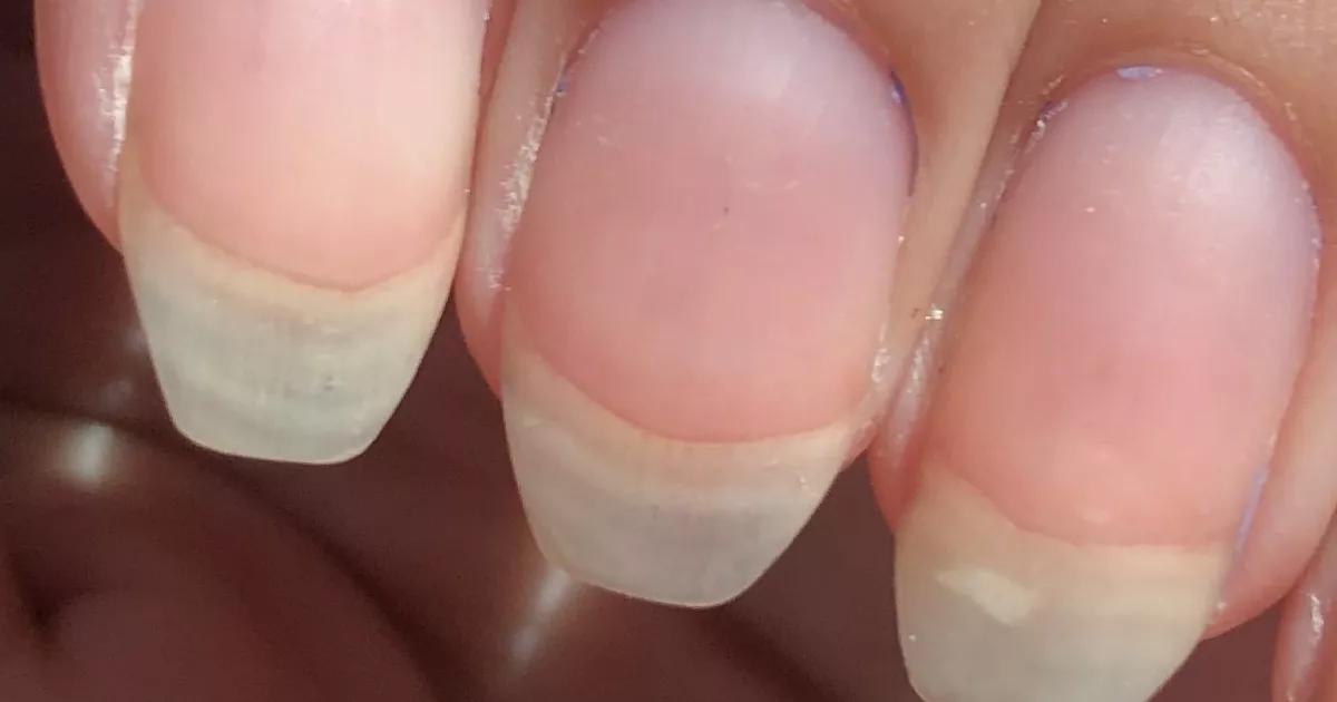 Unhas Fracas? Descubra os Formatos que Aumentam a Resistência e Evitam Quebras