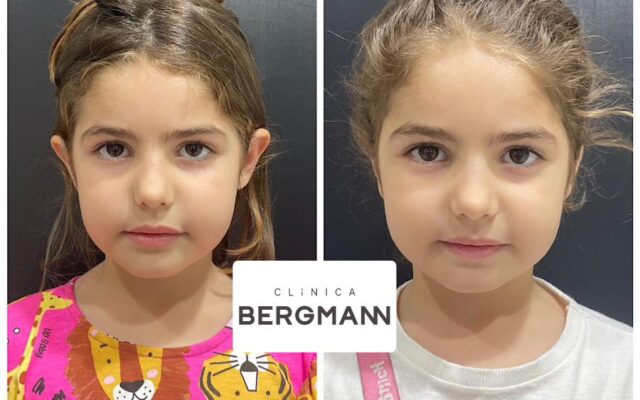 Lavieen vs. Outros Lasers: Qual a Melhor Opção para Você?