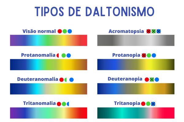 1. O que é Daltonismo e Como Afeta a Visão?
2. Teste de Ishihara: Descubra se Você Tem Daltonismo
3. Os Diferentes Tipos de Daltonismo e Suas Características
4. Daltonismo: Causas Genéticas e Adquiridas
5. Óculos para Daltonismo: Uma Solução Parcial?