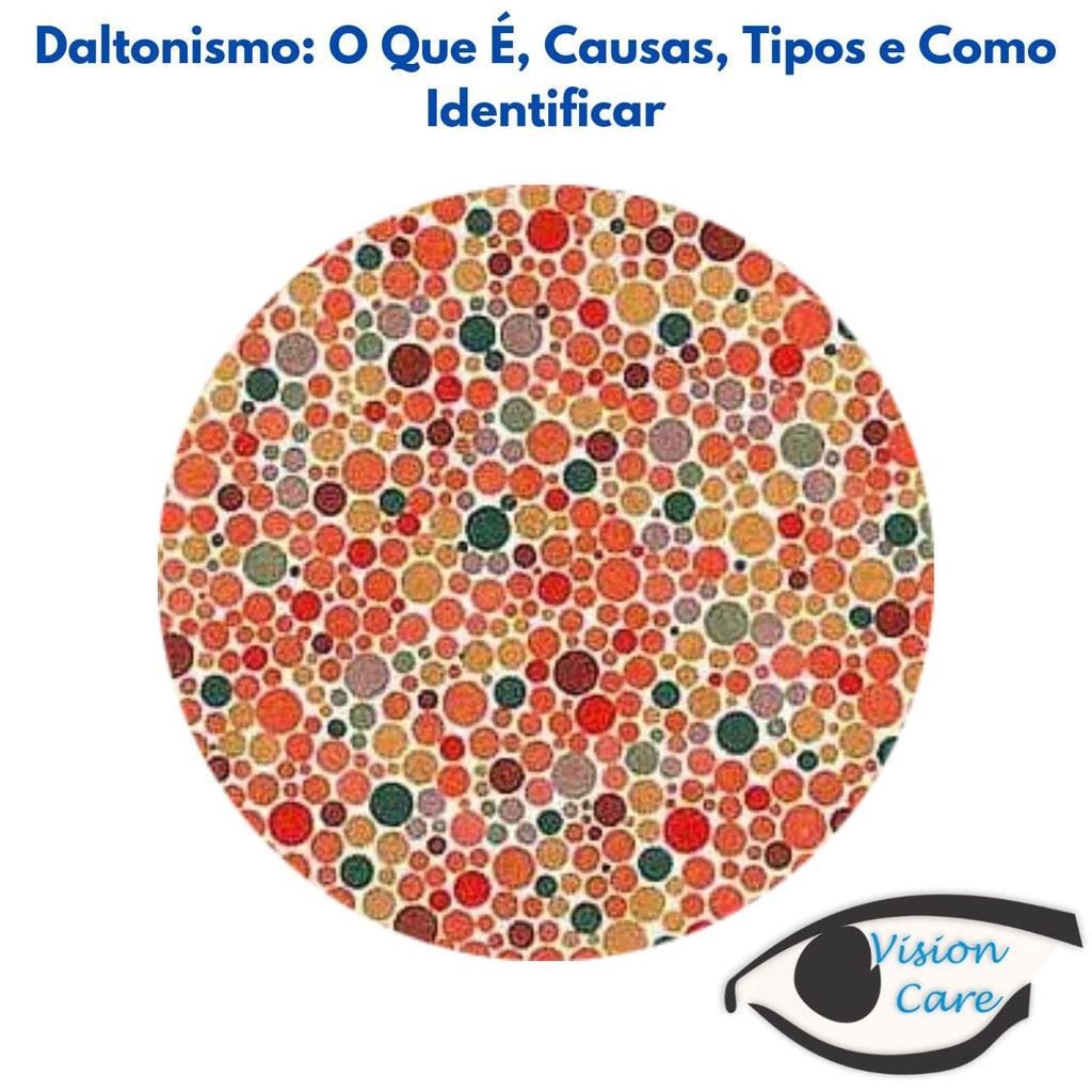 1. O que é Daltonismo e Como Afeta a Visão?
2. Teste de Ishihara: Descubra se Você Tem Daltonismo
3. Os Diferentes Tipos de Daltonismo e Suas Características
4. Daltonismo: Causas Genéticas e Adquiridas
5. Óculos para Daltonismo: Uma Solução Parcial?