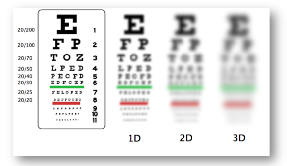 Sintomas e Tratamentos.
2. Como a Genética e os Hábitos Modernos Influenciam a Miopia.
3. Óculos vs. Cirurgia Refrativa: Qual a Melhor Opção para Corrigir a Miopia?
4. Miopia Alta: Riscos e Complicações que Você Precisa Conhecer.
5. Prevenção da Miopia em Crianças e Adolescentes: Dicas Essenciais.