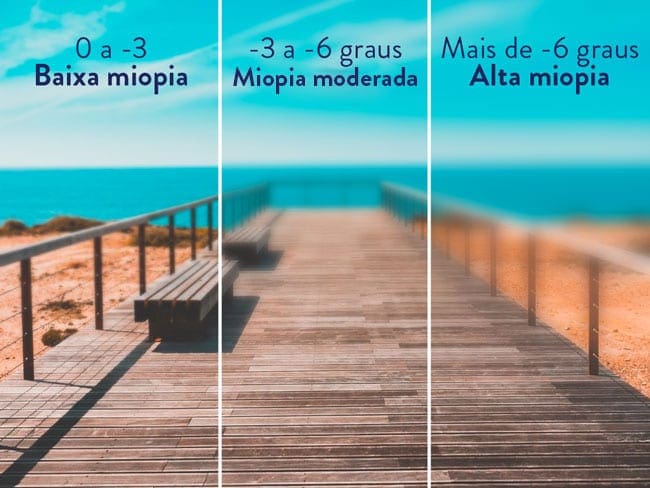 Sintomas e Tratamentos.
2. Como a Genética e os Hábitos Modernos Influenciam a Miopia.
3. Óculos vs. Cirurgia Refrativa: Qual a Melhor Opção para Corrigir a Miopia?
4. Miopia Alta: Riscos e Complicações que Você Precisa Conhecer.
5. Prevenção da Miopia em Crianças e Adolescentes: Dicas Essenciais.