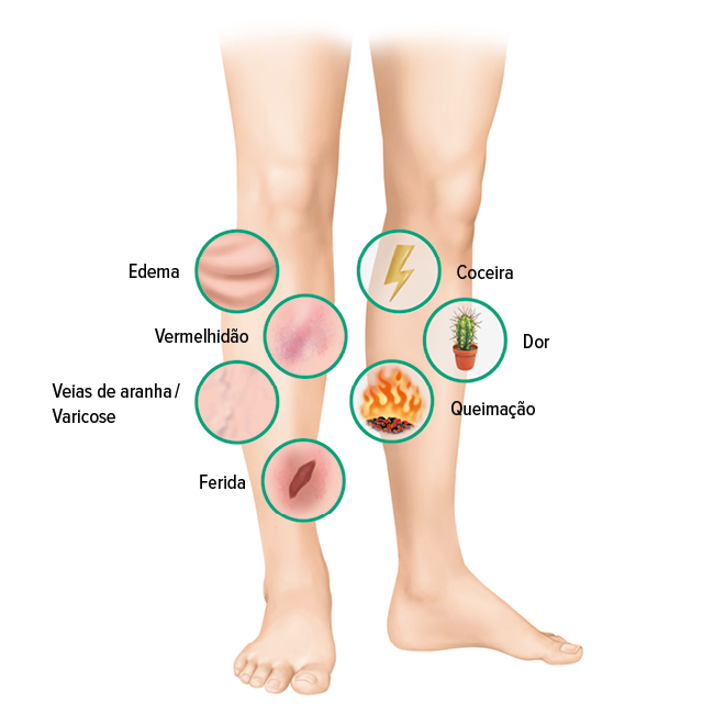 Úlcera Péptica: Entenda as Causas e Sintomas