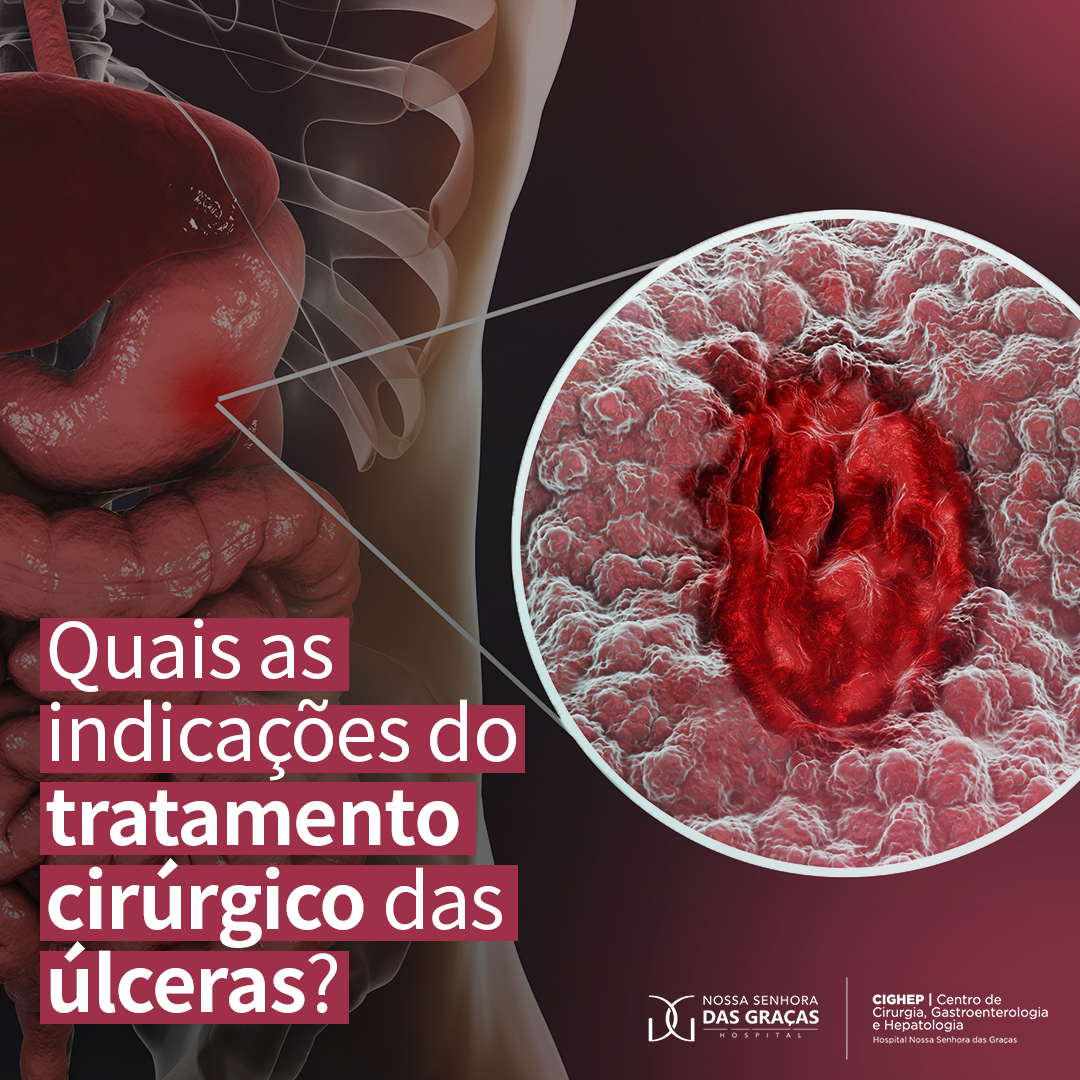 Úlcera Péptica: Entenda as Causas e Sintomas