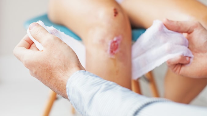 Diagnóstico de Úlceras: Exames e Procedimentos