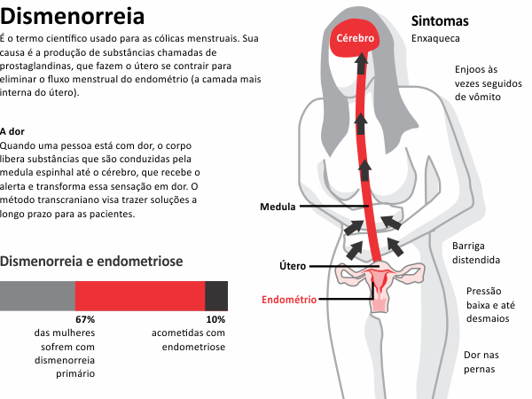 Cólica Menstrual Secundária: Sinais de Alerta e Diagnóstico