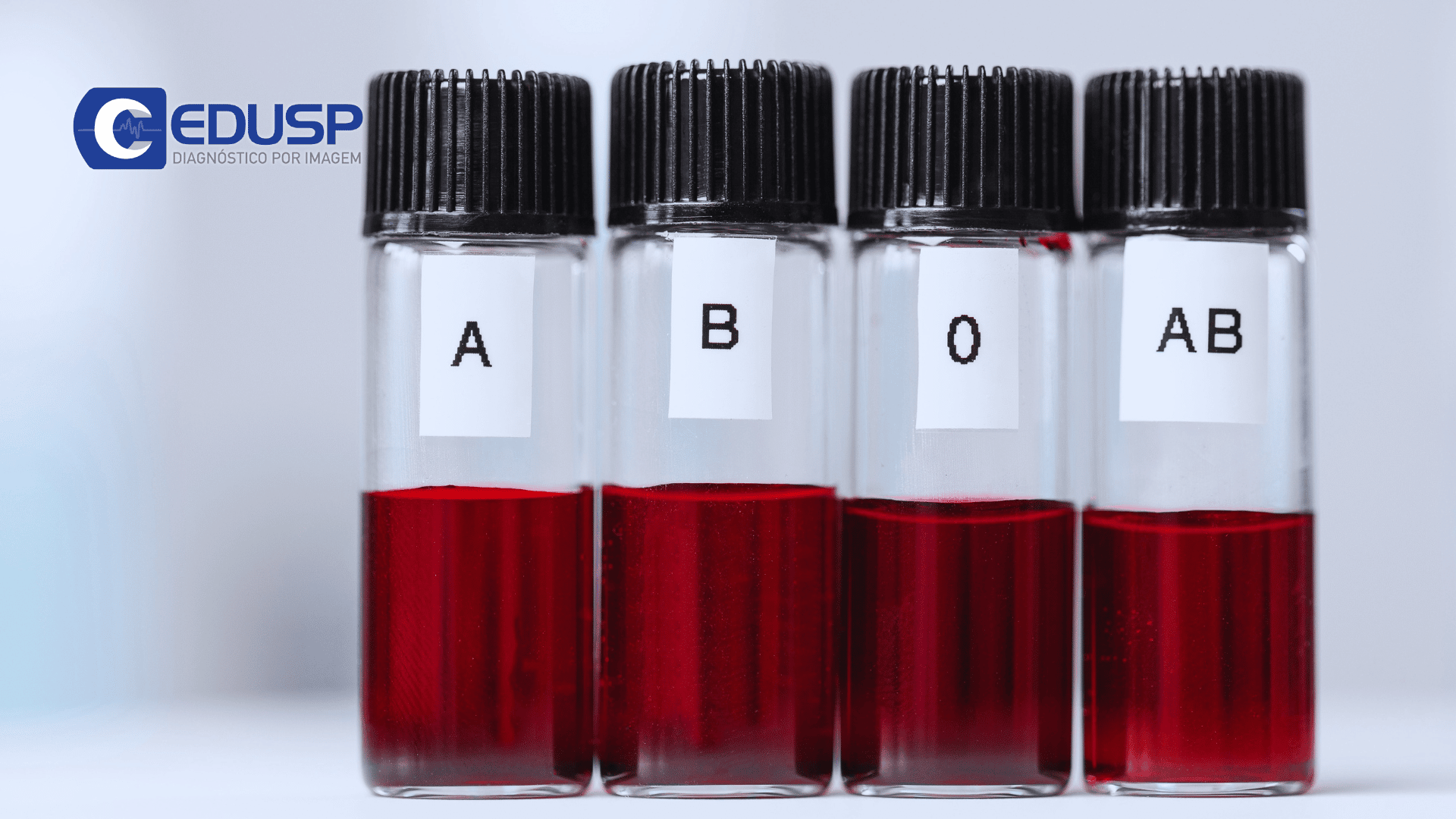1. Como o tipo sanguíneo é determinado geneticamente?
2. A importância do Fator Rh na compatibilidade sanguínea.
3. O que o tipo sanguíneo revela sobre a saúde e evolução humana?
4. Guia completo: Doador Universal vs. Receptor Universal.
5. Mitos e verdades sobre a compatibilidade sanguínea entre pais e filhos.