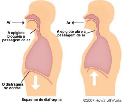 porque temos soluços