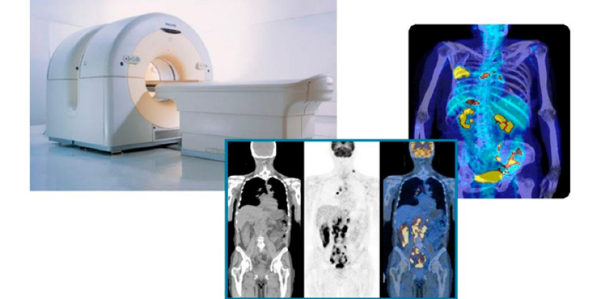 benefícios da tomografia pet para sua saúde