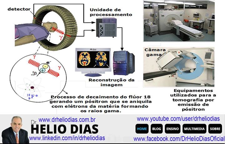 erros comuns no preparo para pet scan