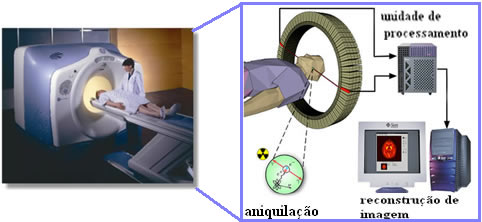 pet scan vs ressonância magnética diferenças