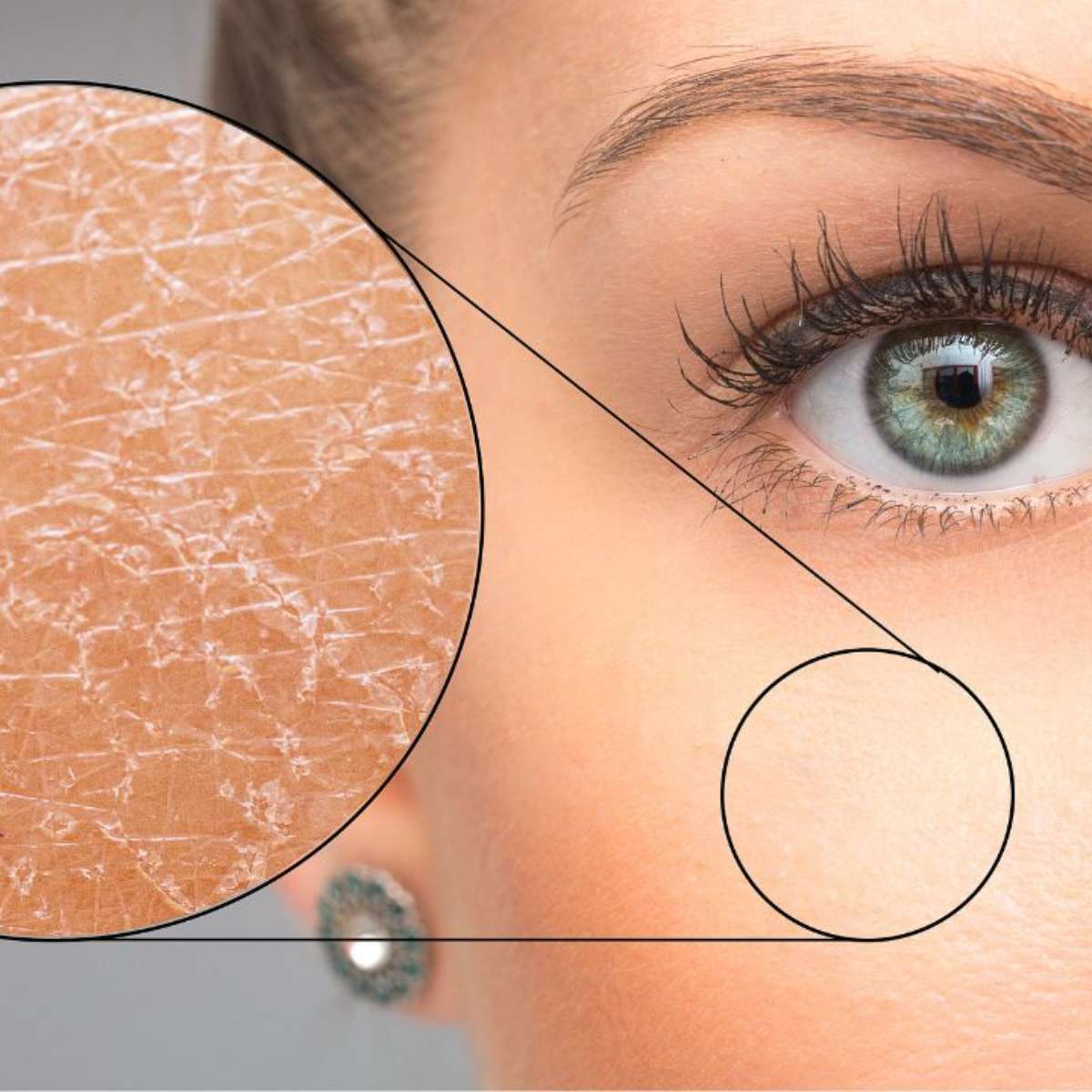 barreira cutânea danificada