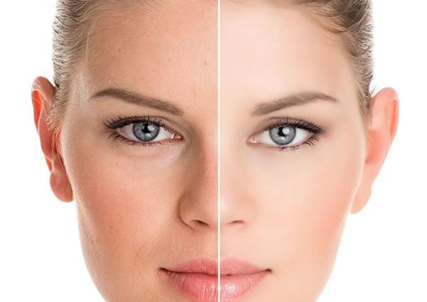 hidratação injetável