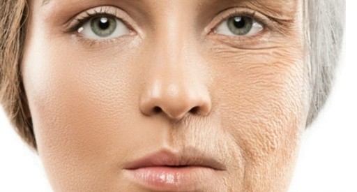 impacto do açúcar na pele