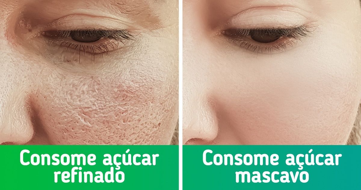 melhores alimentos para proteger colageno da pele