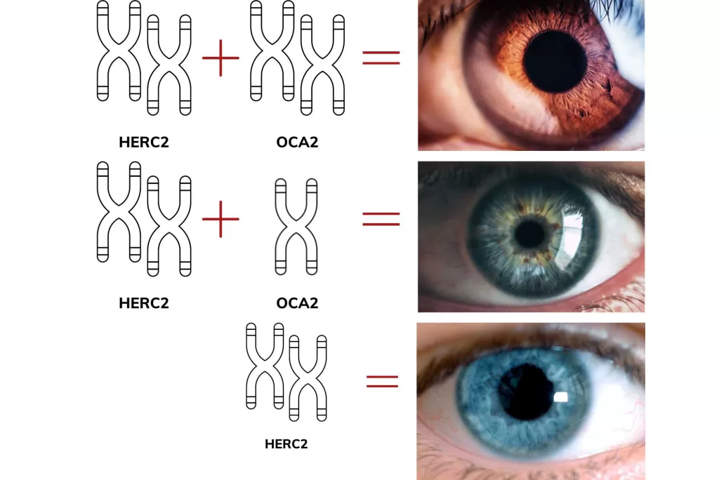 problemas pouca melanina olhos